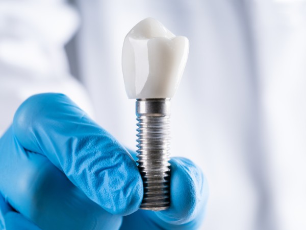 implantes