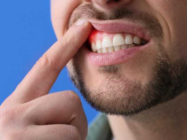 periodoncia foto